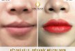 Before And After Lip Treatment And Sculpting Collagen Fix Pale Lips 32
