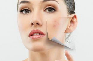 Recognizing Skin Allergies Cosmetics & Treatments 28