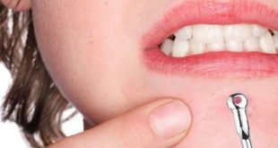 The Secret to Reducing Swelling After Squeezing Acne From Nature 1