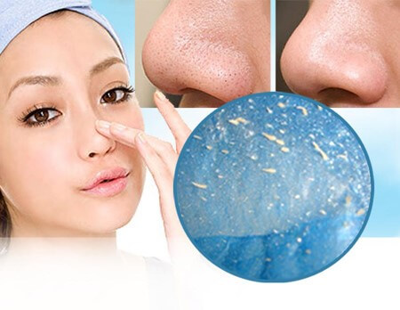 How to treat acne bran effectively