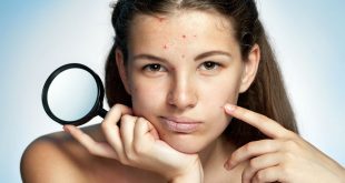 Skin Care Process After Popping Acne 8