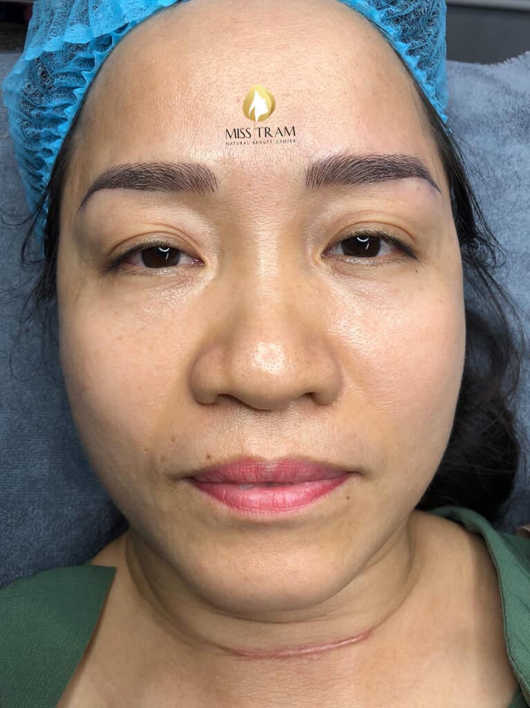 Before And After Treatment of Red Embroidered Eyebrows and Queen Eyebrow Sculpture 11
