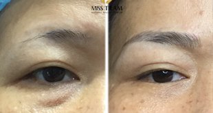 Before And After Sculpting Beautiful Queen Eyebrows For Women 6