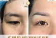 Before And After The Queen's Eyebrow Sculpting Results For Women 16