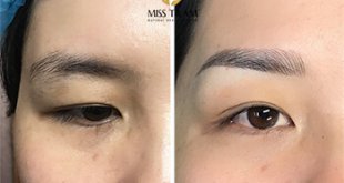 Before And After The Queen's Eyebrow Sculpting Results For Women 9
