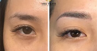 Before And After Beautiful Queen Eyebrow Sculpting Results For Women 6