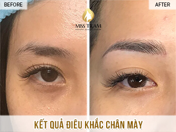 Before And After Beautiful Queen Eyebrow Sculpting Results For Women 4