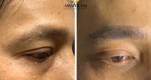Before And After Male Eyebrow Sculpting Results Masculine Posing 1