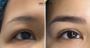 Before And After Eyebrow Sculpting And Eyelid Spray 1