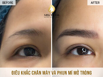 Before And After Eyebrow Sculpting And Eyelid Spray 6