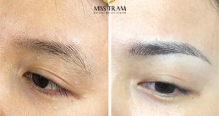 Before And After Sculpting Eyebrows with 9D Threads Overcoming Messy Ingrown Eyebrows 1