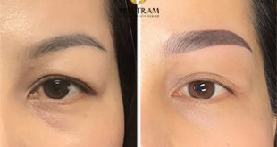Before And After Treating Old Eyebrows - Head Sculpting Combined with Eyebrow Powder Spraying 11