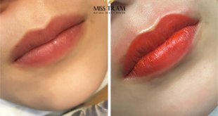 Before And After Deep Treatment Results - Collagen Lip Spray For Women 1