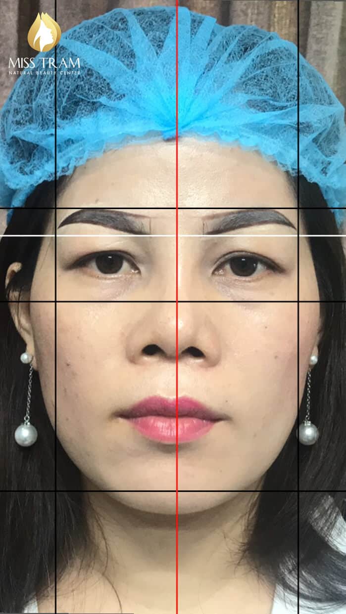 Before And After Treating Old Eyebrows - Head Sculpting Combined with Eyebrow Powder Spraying 7