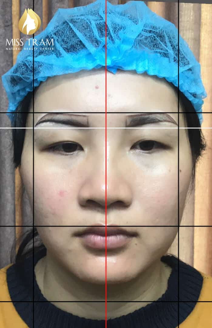 Before And After The Queen's Eyebrow Sculpting Results For Women 7