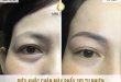 Before And After Eyebrow Sculpting Correcting Irregular Eyebrow 7