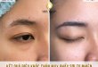 Before And After Using Eyebrow Sculpting Technology For Women 24