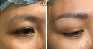 Before And After Beautiful Queen Eyebrow Sculpting Results For Women 12