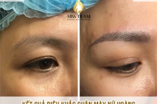 Before And After Beautiful Queen Eyebrow Sculpting Results For Women 142
