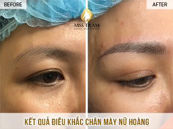 Trước Và Sau Kết Quả Điêu Khắc Chân Mày Nữ Hoàng Đẹp Cho Nữ 4