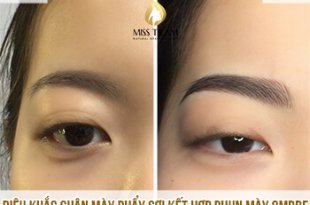 Before And After The Treatment And Sculpting Of Old Eyebrows 89