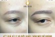 Before And After Treatment And Sculpting Queen's Eyebrows 35