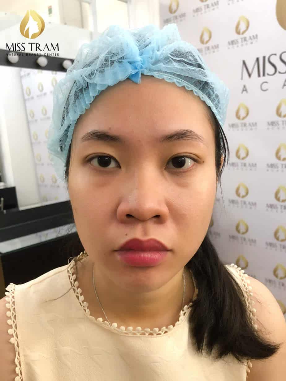 Before And After Using Eyebrow Sculpting Technology For Women 5