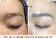 Before And After Covering Eyebrow Scars With 2 . Thread Sculpting Method