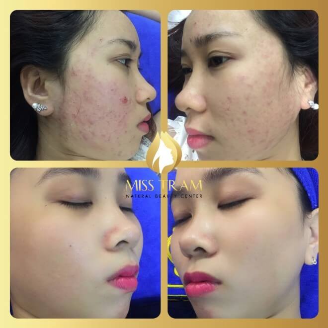 Skin Care and Treatment Specialist Training Course 11