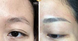 Before And After The Queen's Eyebrow Sculpting Result, Beautiful 1