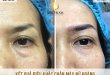 Before And After Super Beautiful Queen Eyebrow Sculpting Technology 20