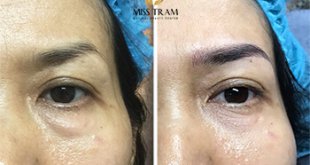 Before And After Super Beautiful Queen Eyebrow Sculpting Technology 43