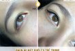 Before And After Spraying Young Fishtail Eyelids For Women 51