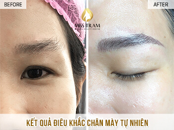 Before And After Beautifying Your Eyebrows With Sculpting Technology 5