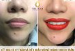 Before And After Sculpting Lips Ink Queen Creates Natural Pink Color 22