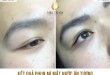 Before And After "Impressive" Water Eyelid Spray At Spa 6