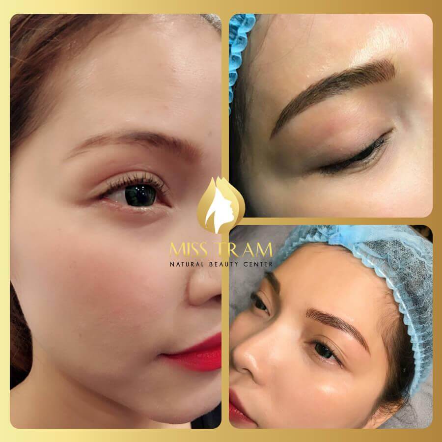 Do You Need Miles After Sculpting Your Eyebrows?