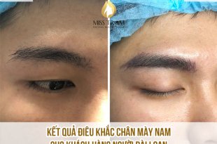 Before And After Sculpting Beautiful Eyebrows For Men 23