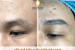 Before And After Beautifying Eyebrows With Sculpting Technology 18
