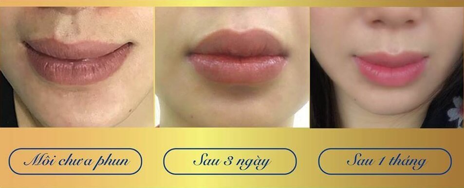 How To Spray Lips Without Swelling 9