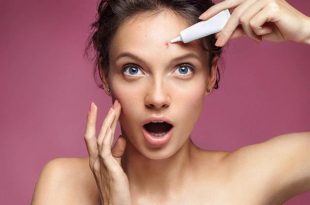 How long does it take to treat Acne 14