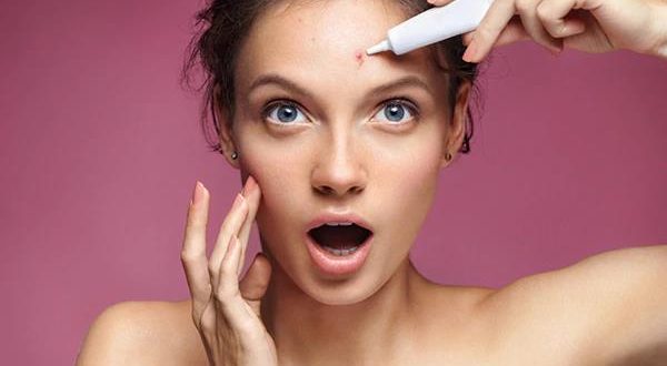How long does it take to treat Acne 4