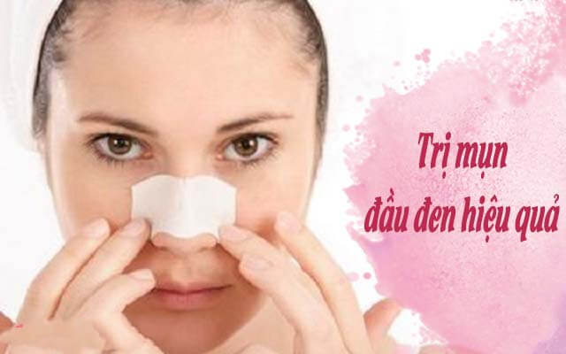 cách trị mụn đầu đen trên trán