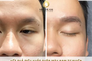 Before And After Perfecting Sculpted Eyebrows For Men 32