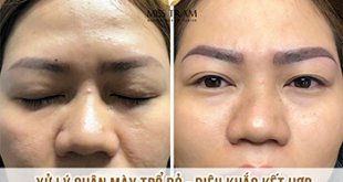 Before And After Treatment of Red Eyebrow - Sculpting and Spraying Ombre 17