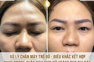 Before And After Treatment of Red Eyebrow - Sculpting and Spraying Ombre 39