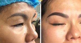 Before And After Treatment of Old Eyebrows - Sculpture Combined with Shading Spray 28