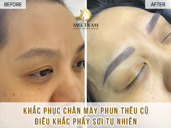 Trước Và Sau Khi Khắc Phục Mày Phun Thêu Cũ Điêu Khắc Mày Mới 6