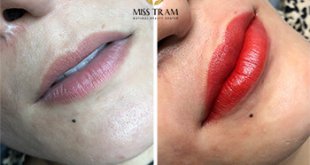 Before And After Sculpting Red and Orange Queen Lips For Customers 1