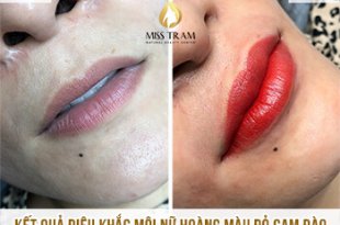 Before And After Sculpting Red and Orange Queen Lips For Customers 8
